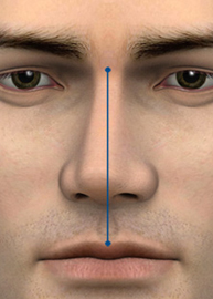 Vertical line shows deviated nose