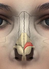 Cephalic Trim - nose surgery - anatomic view