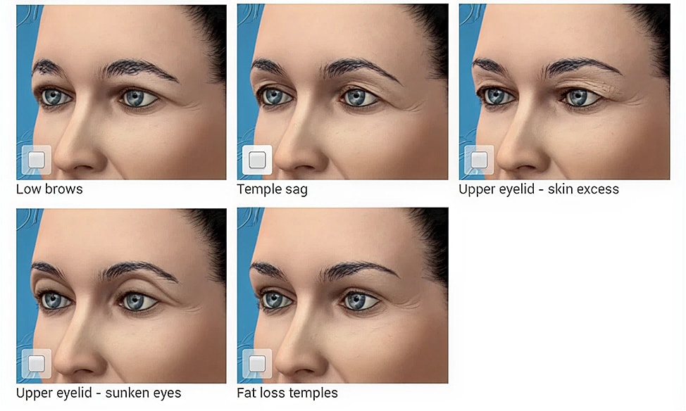 Facial aging features and concerns illustrated.