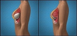 Breast anatomy illustration with cross-section view.