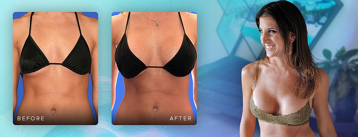 Before and after transformation comparison of body.
