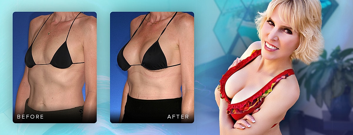 Before and after body transformation comparison.