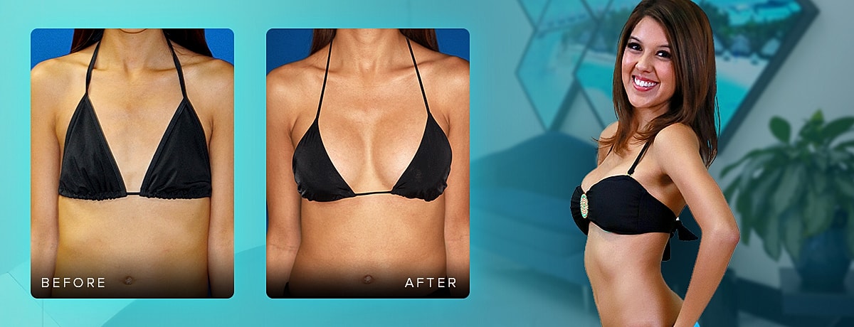 Before and after body transformation comparison.
