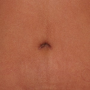 Close-up of a human abdomen with navel.