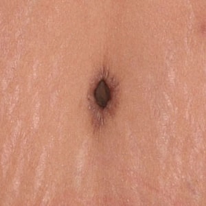Close-up of an abdominal navel area.