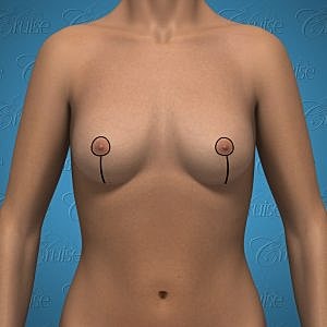 Anatomical illustration of female torso.