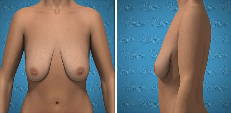 3D female torso from multiple angles.
