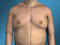 Male torso front view on blue background.