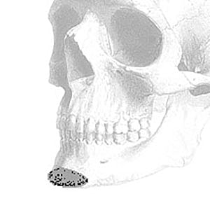 Skeletal skull illustration with dotted chin area.
