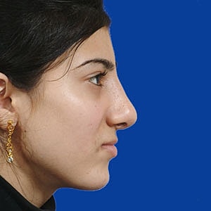 Profile view of a young woman with earrings.