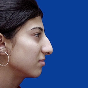 Profile of a young woman against a blue background.