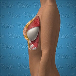 Anatomical illustration of the female breast.