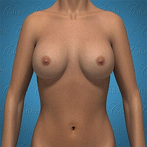 3D rendered female torso with neutral background.