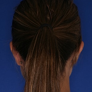 Back view of a person with ponytail.