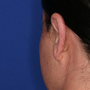 Close-up of ear against blue background.