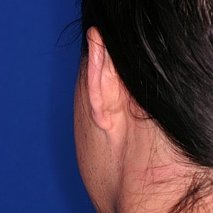 Close-up of a person's ear and neck.
