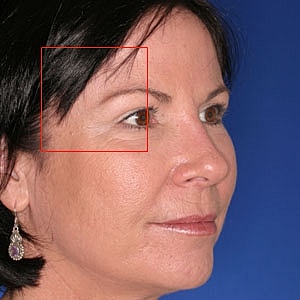 Close-up of a woman's profile with earrings.