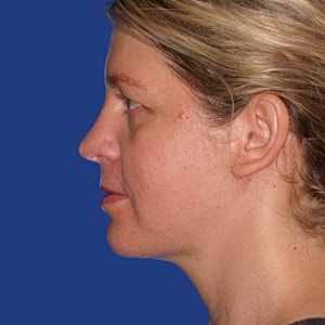 Profile of a woman against a blue background.
