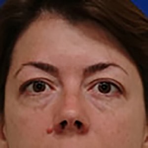 Close-up of a woman's face with neutral expression.
