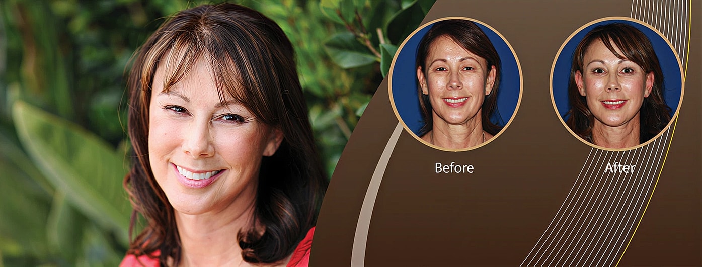 Before and after cosmetic treatment comparison image.