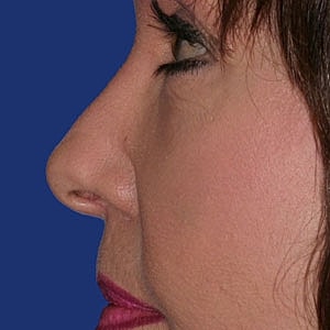 Profile view of a woman's face.