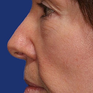 Side profile of a woman's face.