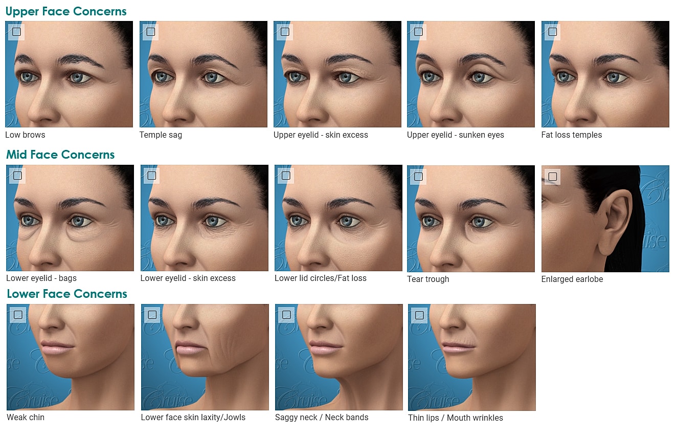 Facial aging concerns and treatment options illustrated.