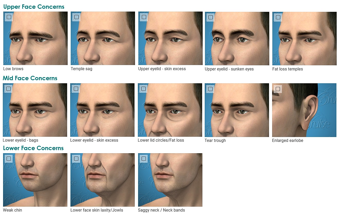 Facial concerns and treatments illustrated for men.