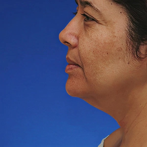 Woman's profile against blue background.
