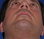 Man looking up with facial details visible.