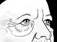 Detailed illustration of facial muscles and features.