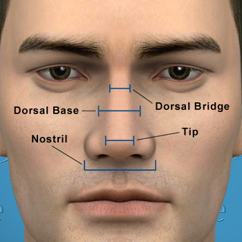 1-ideal-front-male-different-nasal-widths