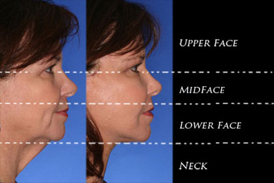 Regions of the face and neck