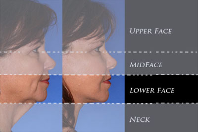 Region of the lower face