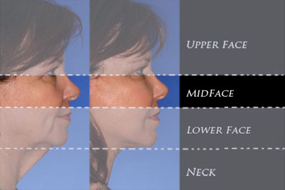 Region of the mid face