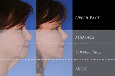 Region of the upper face