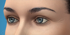 Animated removal of bags under the eyes