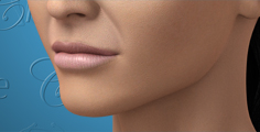 Animated chin augmentation