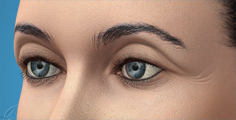Animated Fat Transfer to Upper Eyelid