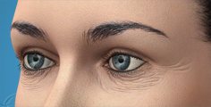 Animated lower eyelid skin removal