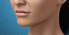 Animation of thin lips and upper lip wrinkles