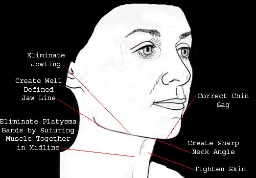 Diagram of youthful neck