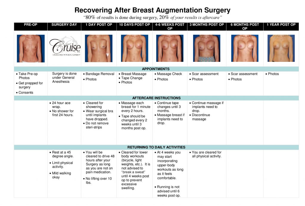 Breast Augmentation timeline