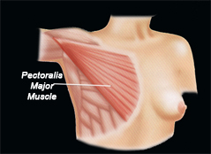 Pectoralis-Major-Muscle1