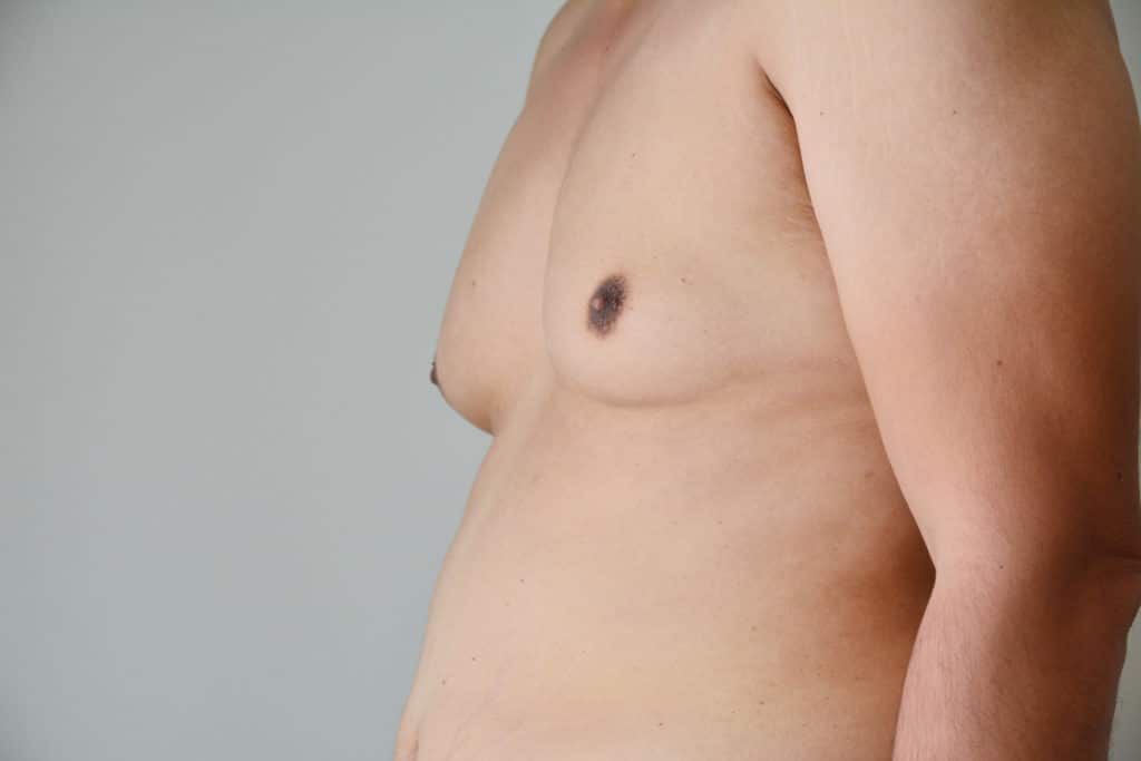 male chest with man boobs