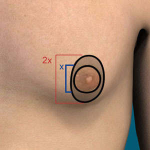 Diagram of nipple size and donut lift limitations