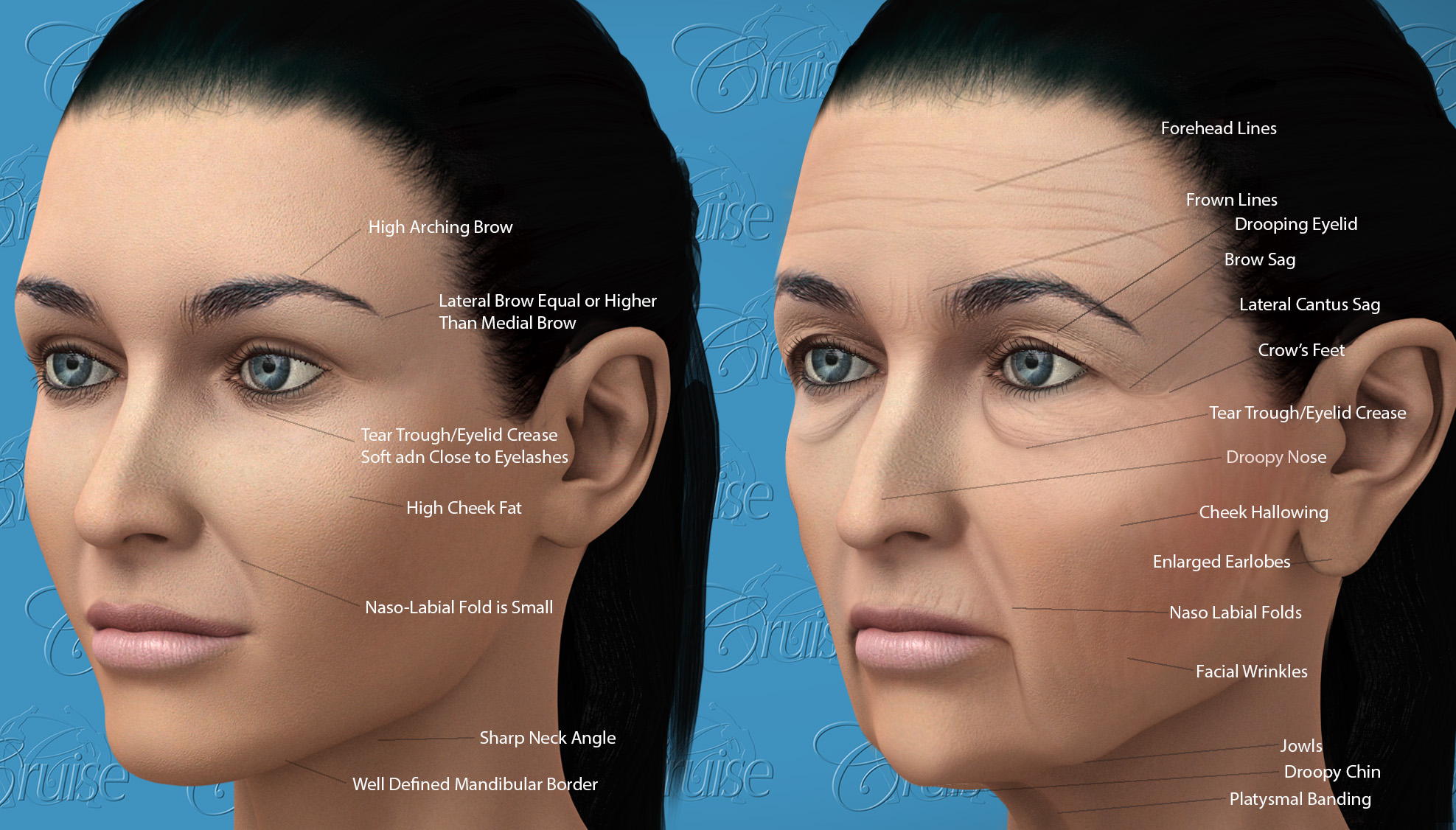 Facial Aging Anatomy