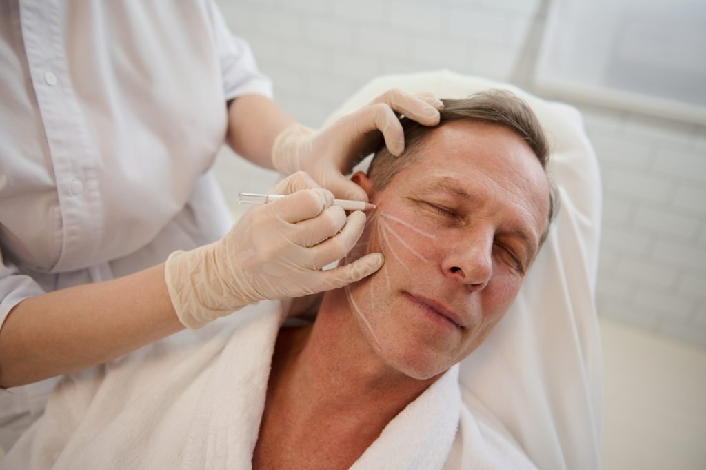 man prepping for male facelift