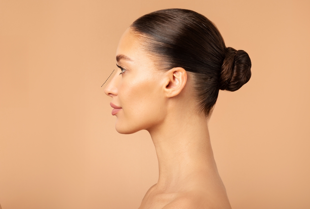 Rhinoplasty in Orange County California